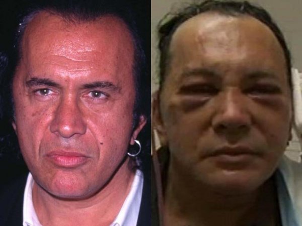 9270360_gene simmons