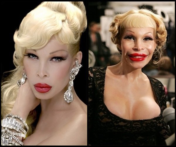 Amanda-Lepore-plastic-surgery