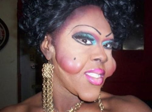 bad-plastic-surgery-17