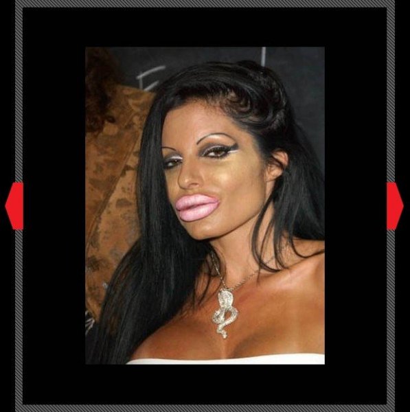 plastic-surgery-disasters-new