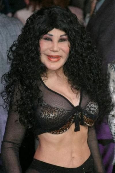 plastic_surgery_fails_that_are_just_wrong_640_06