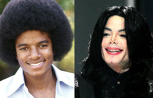 xmichael-jackson-plastic-surgery.jpg.pagespeed.ic.3lv-Jb68389PaGGlcOgu